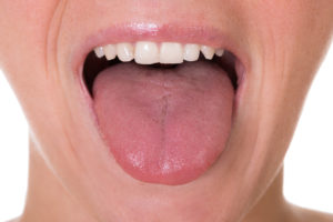 舌から見る漢方治療の実際