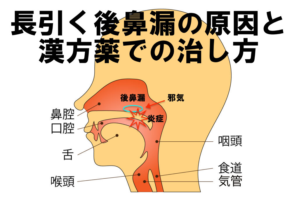 抗ヒスタミン薬